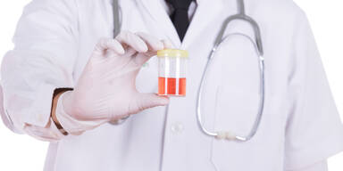 Wie gef&auml;hrlich ist Blut im Harn?