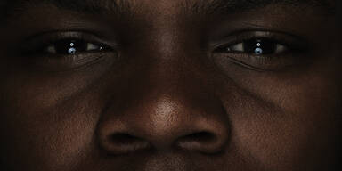 USA: Schwarze sterben vier Jahre fr&uuml;her als wei&szlig;e US-B&uuml;rger