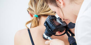 Neue Hoffnung bei Hautkrebs