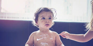 Immer mehr Masern-Tote auf den Philippinen