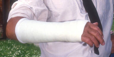 Wien: Bauunternehmer l&auml;sst Mann beide Arme brechen