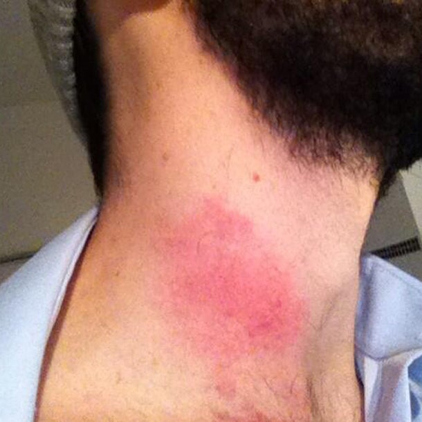 Eishockey-Goalie twittert Schock-Bild