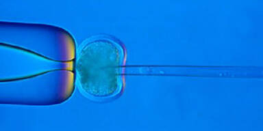 Chromosomen im Zellkern einer Eizelle - Klonen