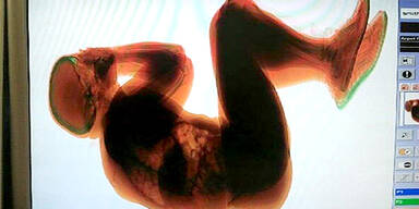 Fiumicino: Betrunkener landet in Gep&auml;ck-Scanner