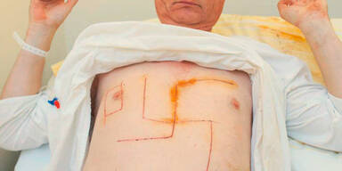 "Hakenkreuz-Opfer" und Ehefrau verurteilt