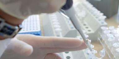 Herstellung des Impfstoffs auf Hochtouren