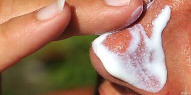 Hohe UV-Dosen überfordern den Körper