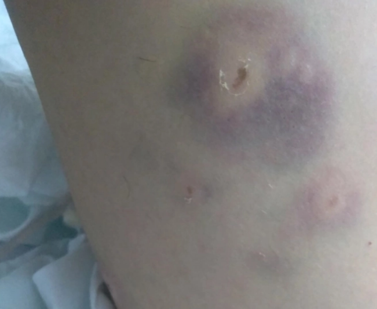 Mutter auf Arbeitsweg beinahe von sieben Hunden aufgefressen