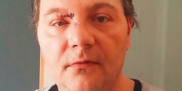 Prügel-Mob verfolgt vier Frauen