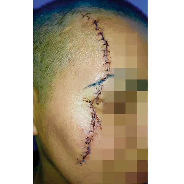 Asylwerber attackierte Frau mit Stanley-Messer