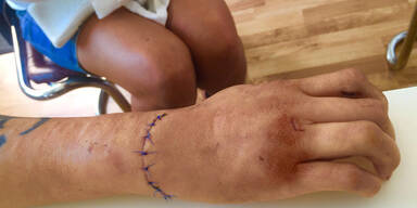 Asylwerber attackierte Frau mit Stanley-Messer