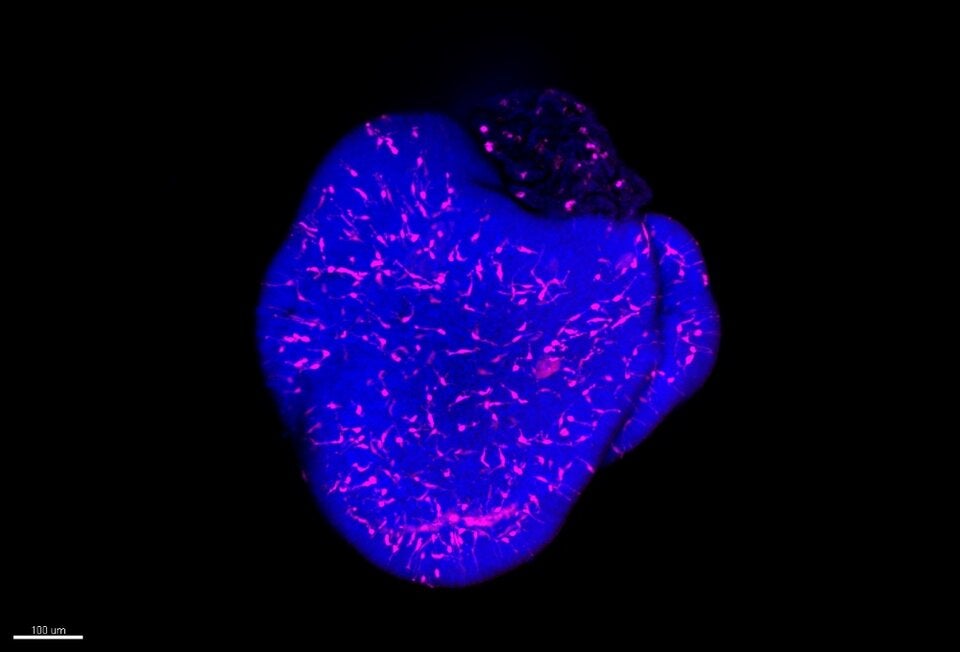 Wie ein rosa-leuchtender Himmel: Mikroglia (Magenta), eingebettet in einem retinalen Organoid. Die Zellkerne (Mitte der Zellen) der Neuronen sind blau gefärbt. 