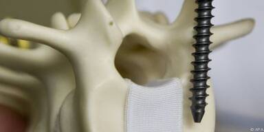 Infektionen weit verbreitet