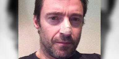Hugh Jackmans schwerer Schock!
