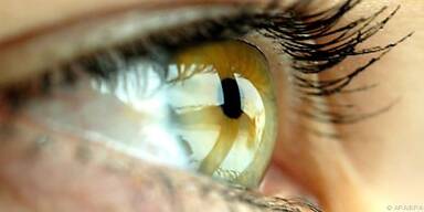 Trockene Augen sind anfälliger für Entzündungen