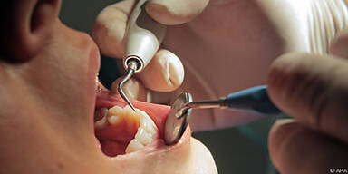 Kariesprobleme nehmen ab