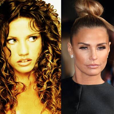 So krass verändern Schönheits-Operationen