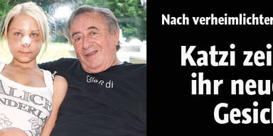 Jetzt zeigt Katzi ihre neue Nase