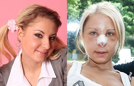 Katzi Anastasia Sokol neue Nase