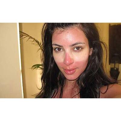 Die 15 schlimmsten Beauty-Pannen der Stars