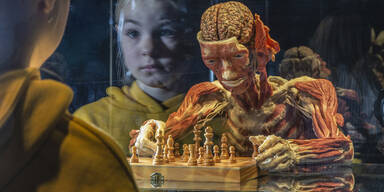 „Körperwelten“ zeigen was uns krank macht