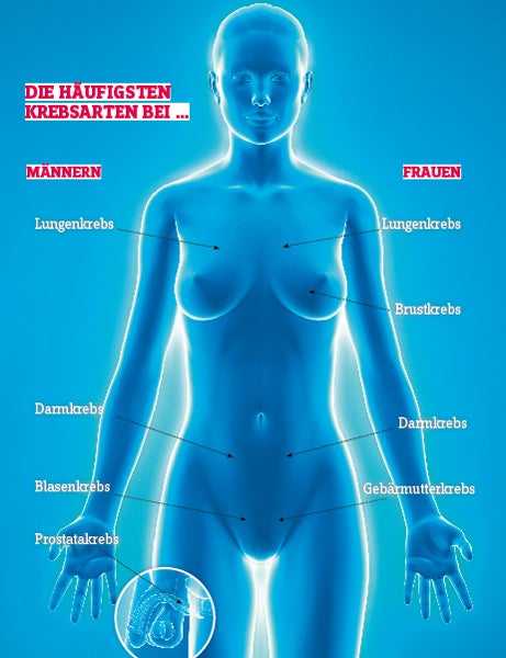 Krebsarten