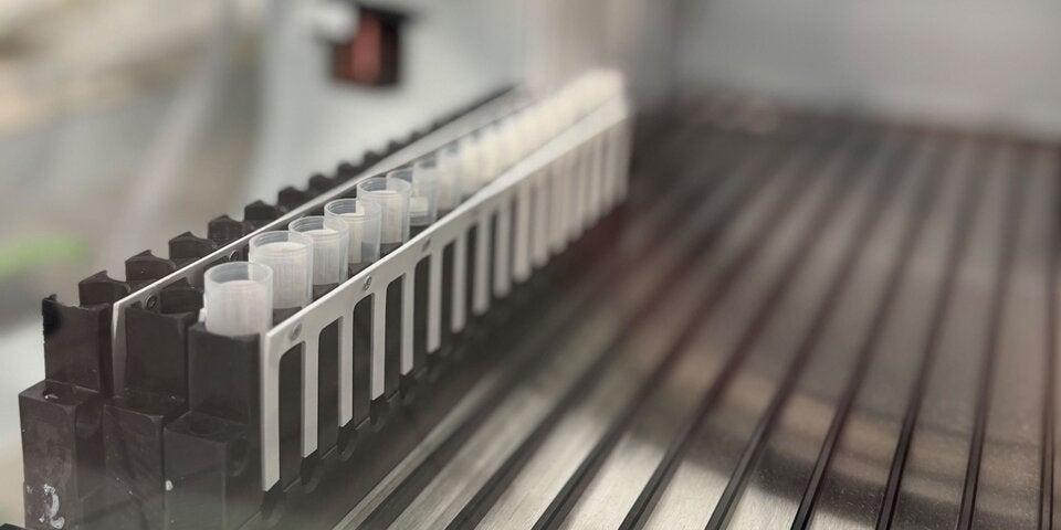 Die Speichelproben im Labor von Biolyz. 