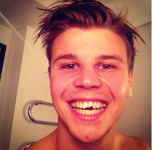 Autsch! BVB-Goalie bricht sich Zähne ab