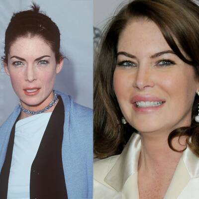 So krass verändern Schönheits-Operationen