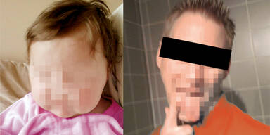 Leonie (2) in heißes Wasser getaucht?