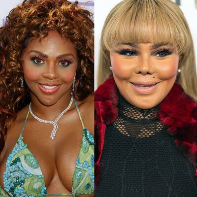 So krass verändern Schönheits-Operationen