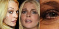 Lindsay Lohan - tiefe Falten mit 23
