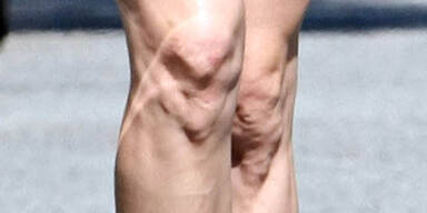 Wem gehören die geschwollenen Knie?