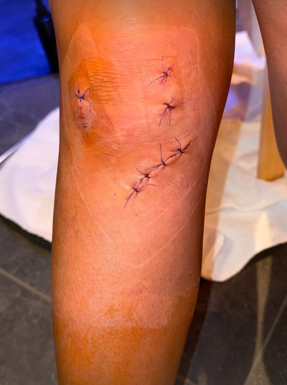 Lombardi Sarah Engels