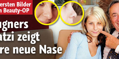 Hier zeigt Lugners Katzi ihre neue Nase