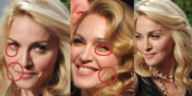 Seltsame Fall der Madonna: Altert sie rückwärts?