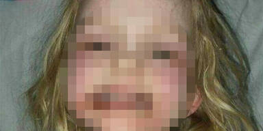 Lydia (3): Horror-Reaktion wegen Make-up