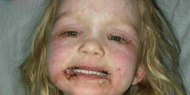 Lydia (3): Horror-Reaktion wegen Make-up