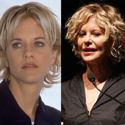 So krass verändern Schönheits-Operationen