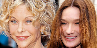 Meg Ryan Carla Bruni Botox