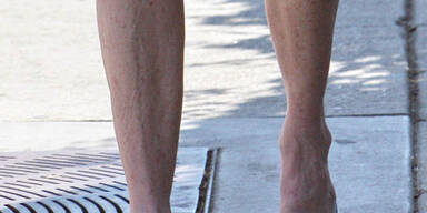 Wenn die Haxen schneller altern als der Busen...