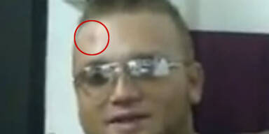 Muss Menowin wegen Beule ins Gefängnis?