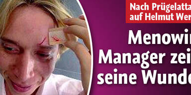 Menowin-Manager zeigt seine Wunden