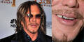 Mickey Rourke: Star mit Zahnproblem? kon