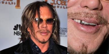 Mickey Rourke: Ein Star mit Zahnproblem?