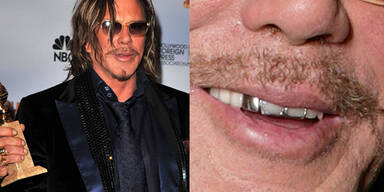 Mickey Rourke: Ein Star mit Zahnproblem?