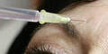 Mit Botox die Mimikfalten außer Gefecht setzen