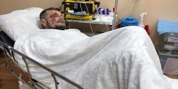 Bombenexplosion in Kiew: Ein Toter, Abgeordneter verletzt