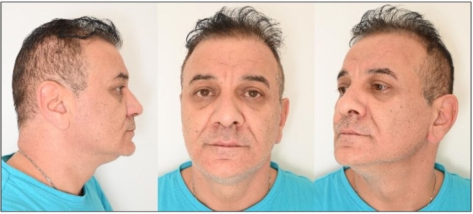 Raub durch K.O.-Tropfen: Polizei sucht weitere Opfer