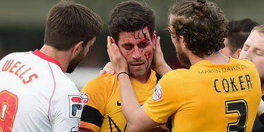 England-Kicker schockt mit Horror-Cut